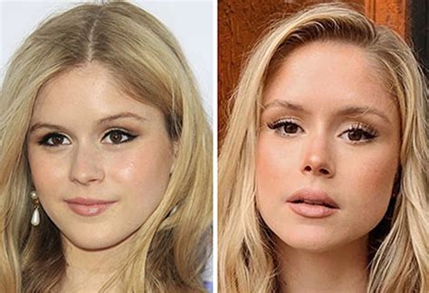 erin moriarty breast implants|Erin Moriarty plastic surgery journey and transformation